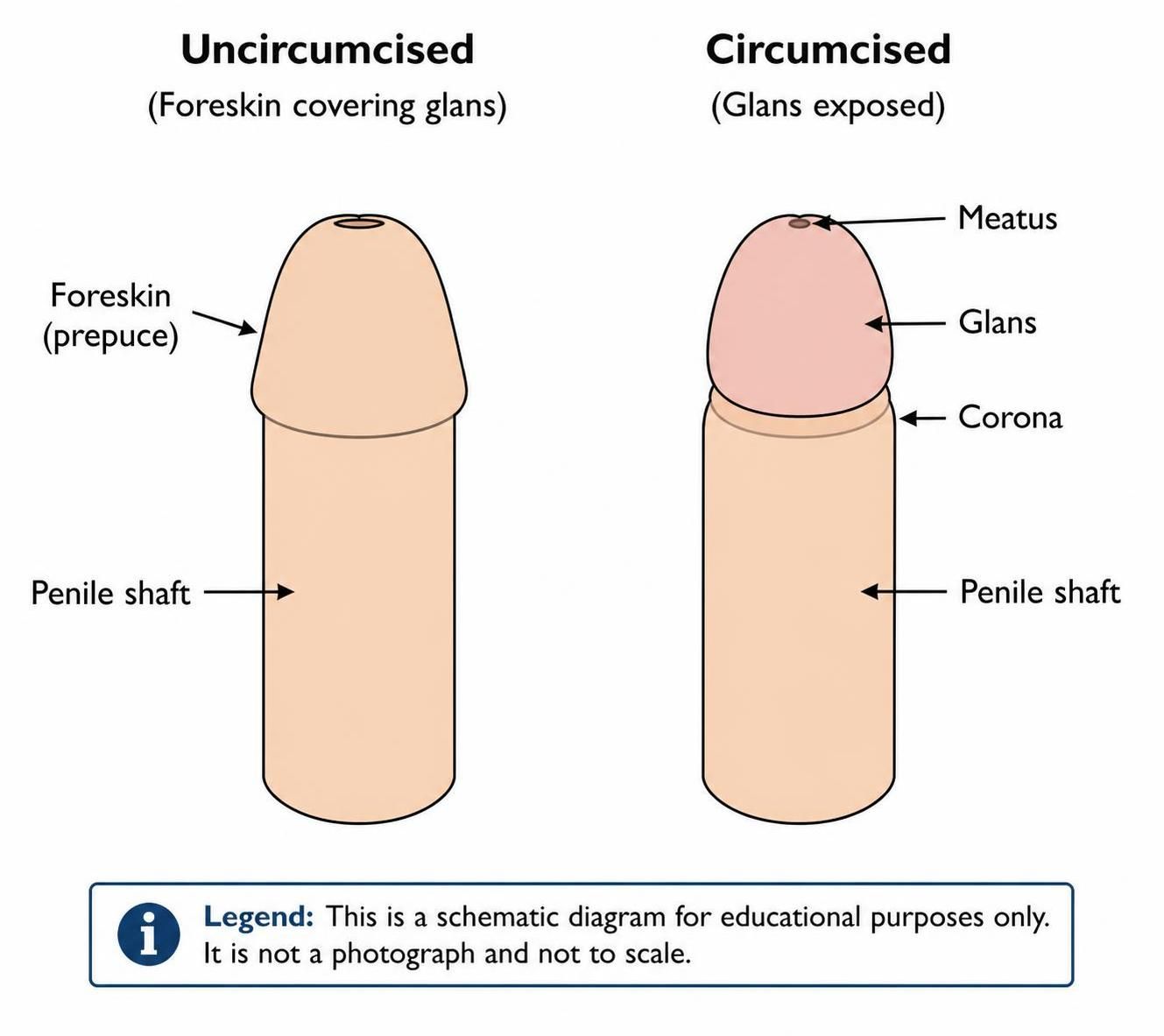 circ uncirc diagram